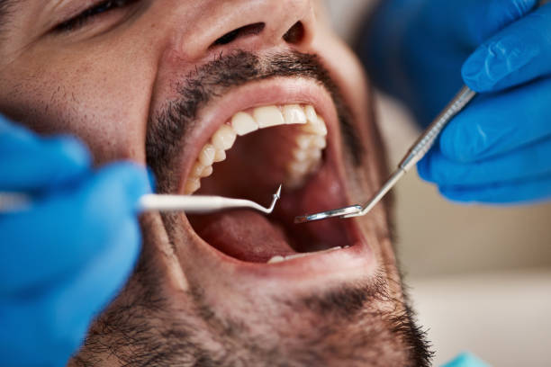 Best Orthodontic Emergency Dentist in Day Valley, CA